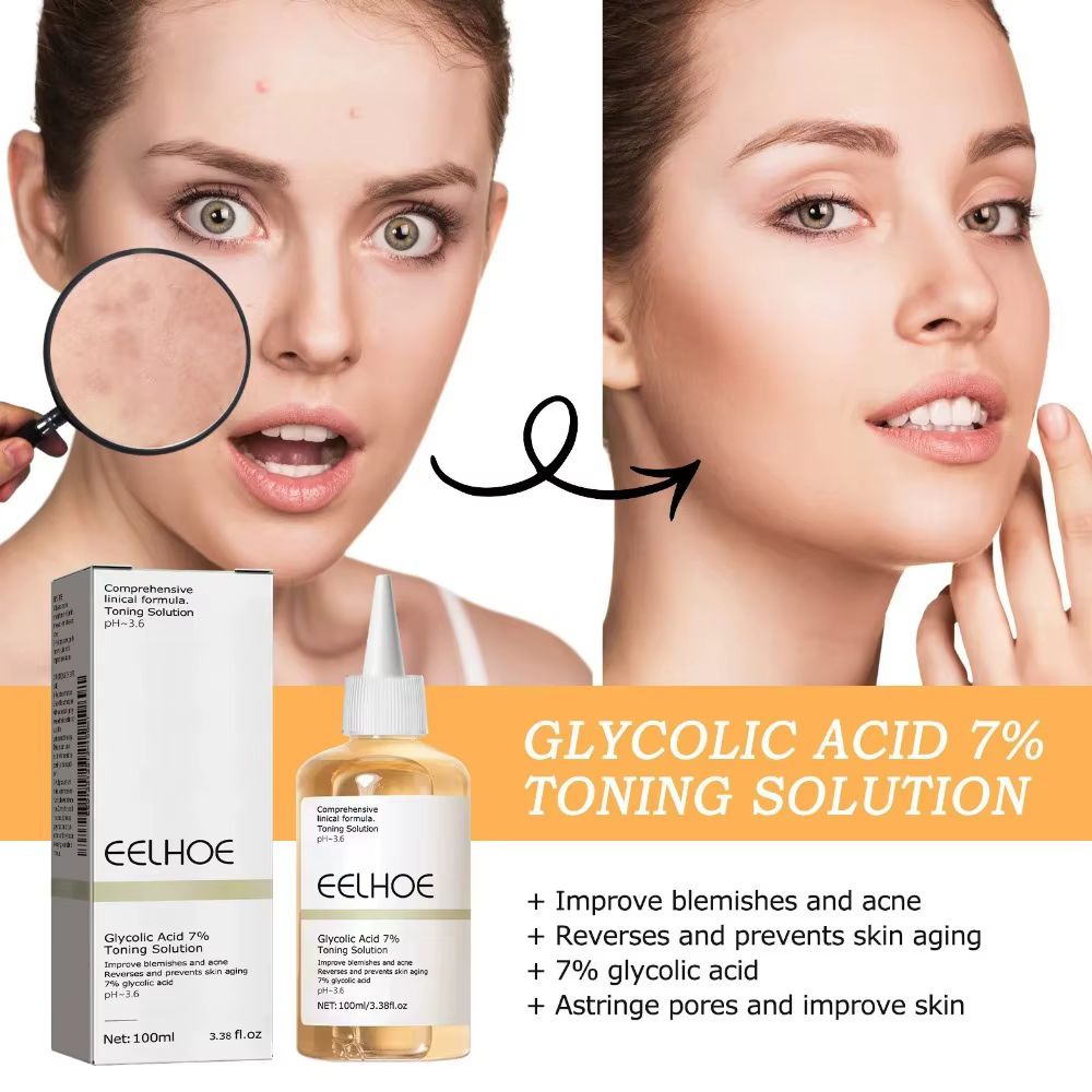 Acide glycolique 7% Solution tonifiante dissolvant d'acné soins de la peau raffermissant hydrater
