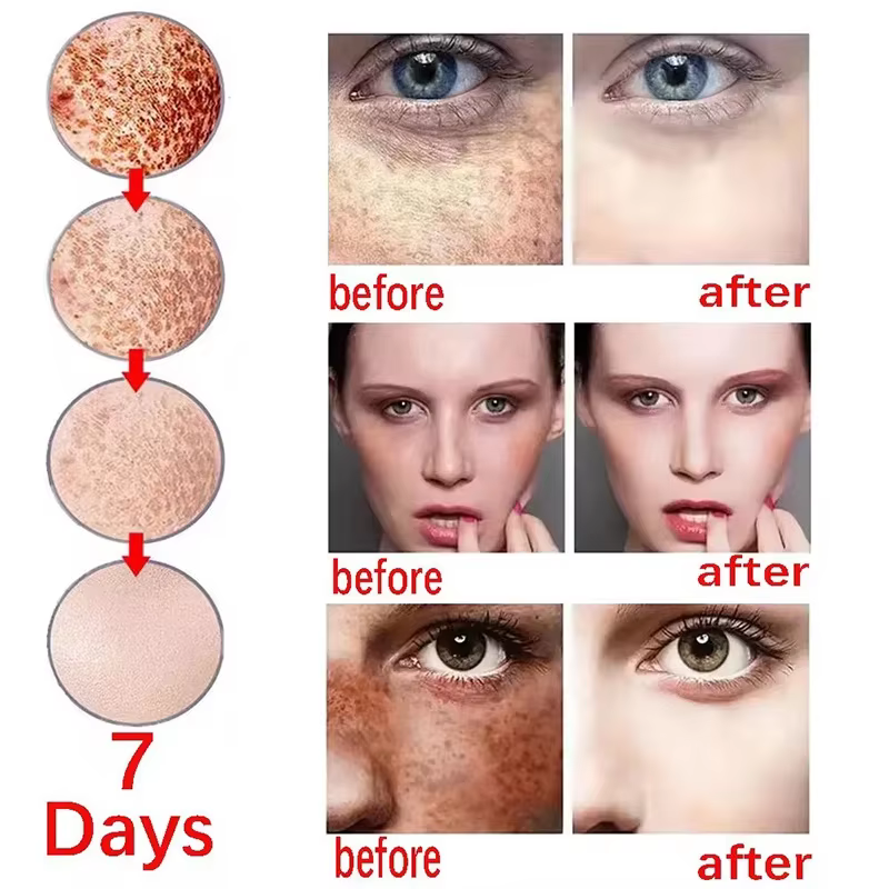 Crème blanchissante pour le visage