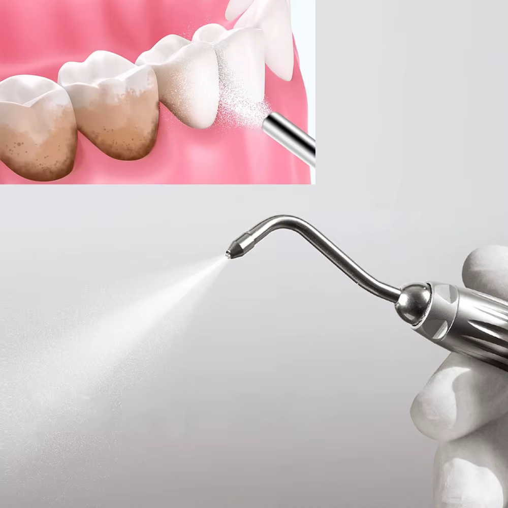 Poudre de polissage dentaire 130g Prophy Air Jet Flow pour le nettoyage des dents, l'élimination de la plaque et des taches, bicarbonate de sodium, menthe, citron, fraise