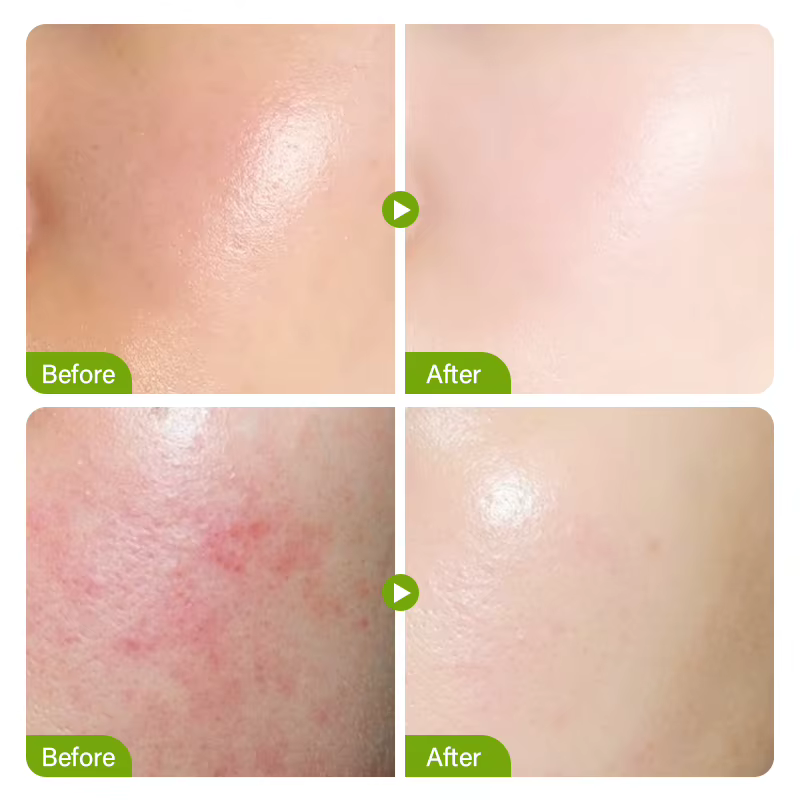 Sérum rétrécit les pores à l'acide salicylique, élimination des grands Pores, élimine les points noirs, réparation lisse du visage, produit de soins pour la peau