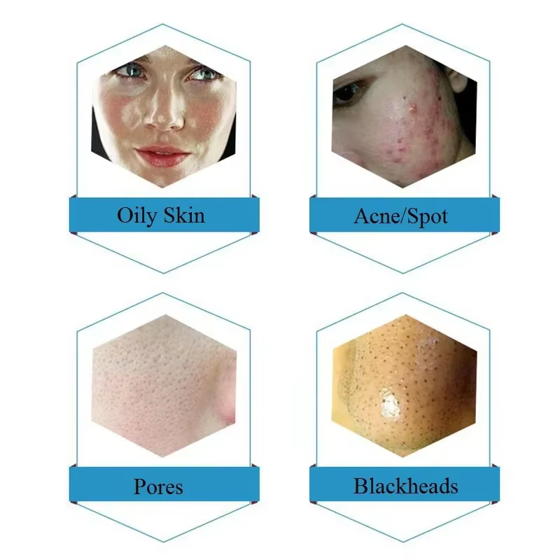 Solution professionnelle dermabrasion