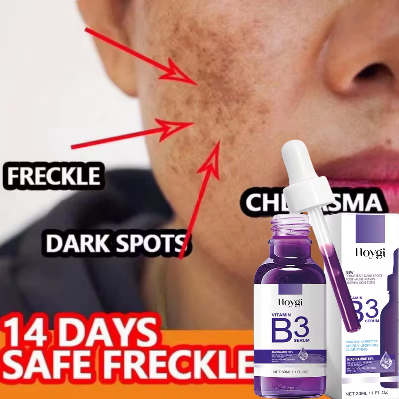 Sérum à la vitamine B3
