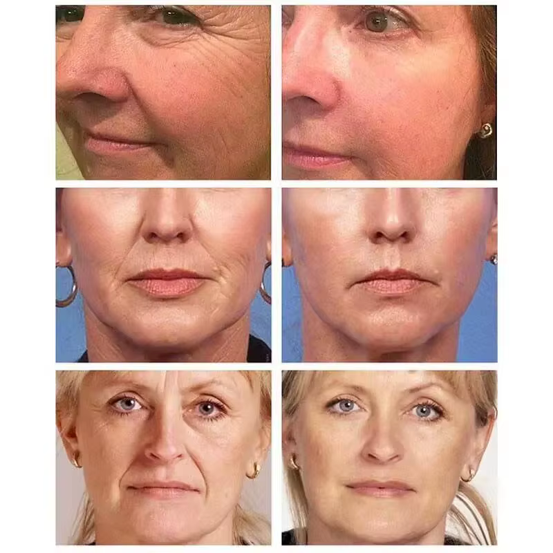 Crème pour le visage au rétinol déformable remodelé