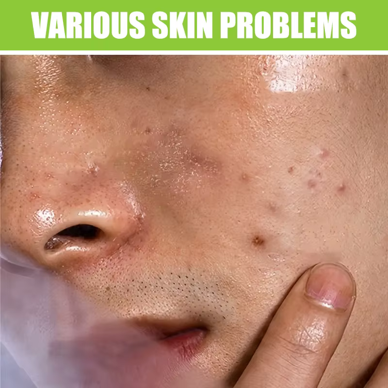 YUITIKUE Lavage du visage pour hommes 60g - Thé vert et acide salicylique