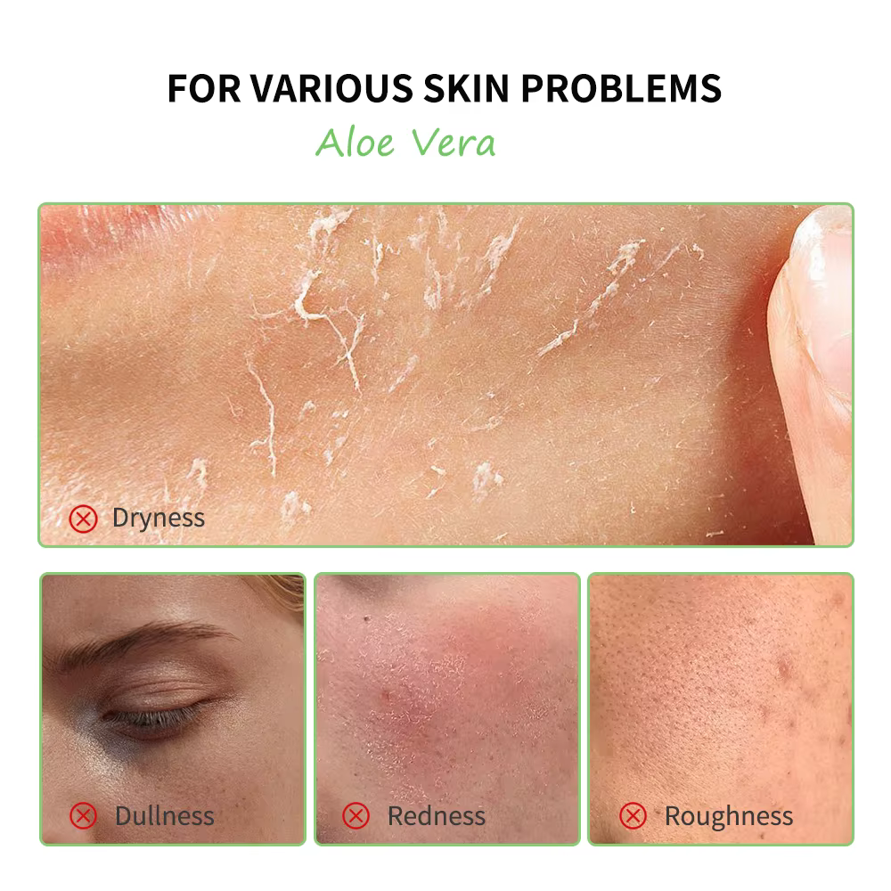 Gel d'aloe vera éclaircissant