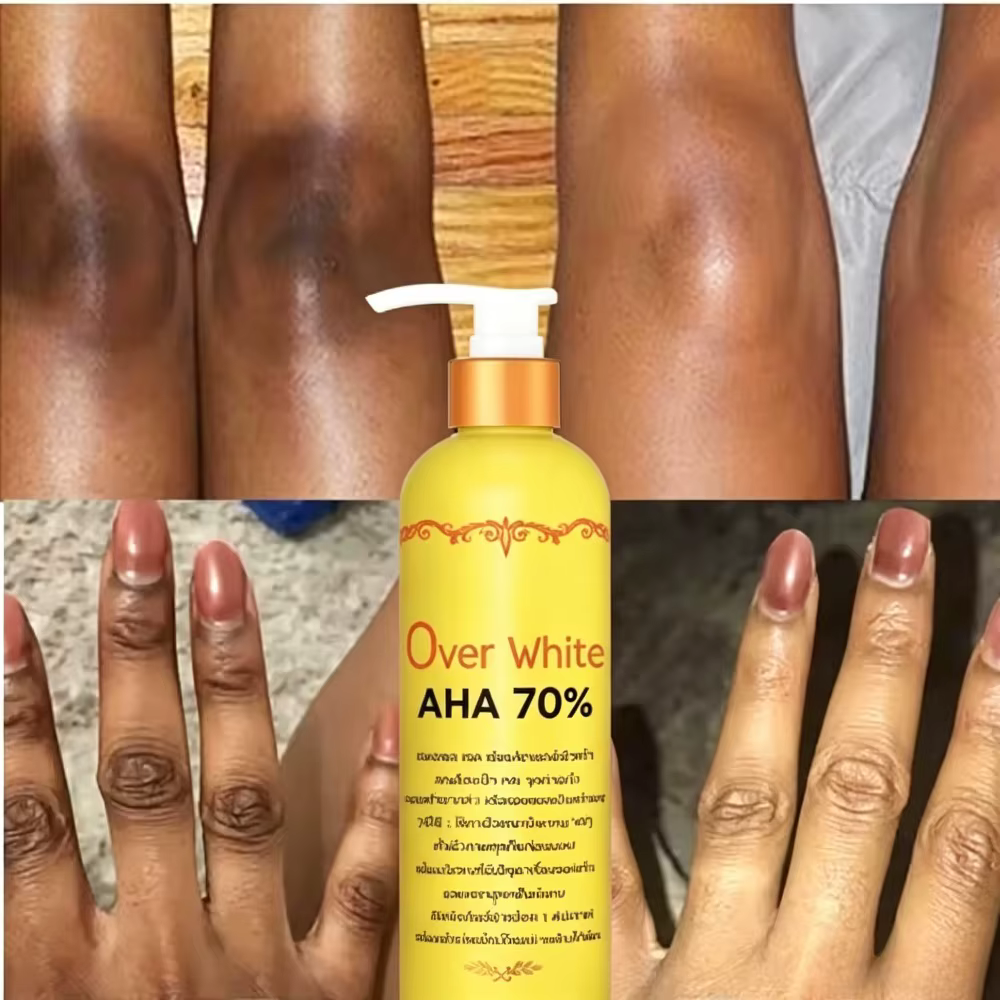 Sérum éclaircissant pour le corps AHA 70% - Élimine les taches sombres - Blanchiment - 120ml
