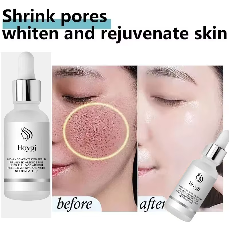 Sérum pour éliminer les grands Pores