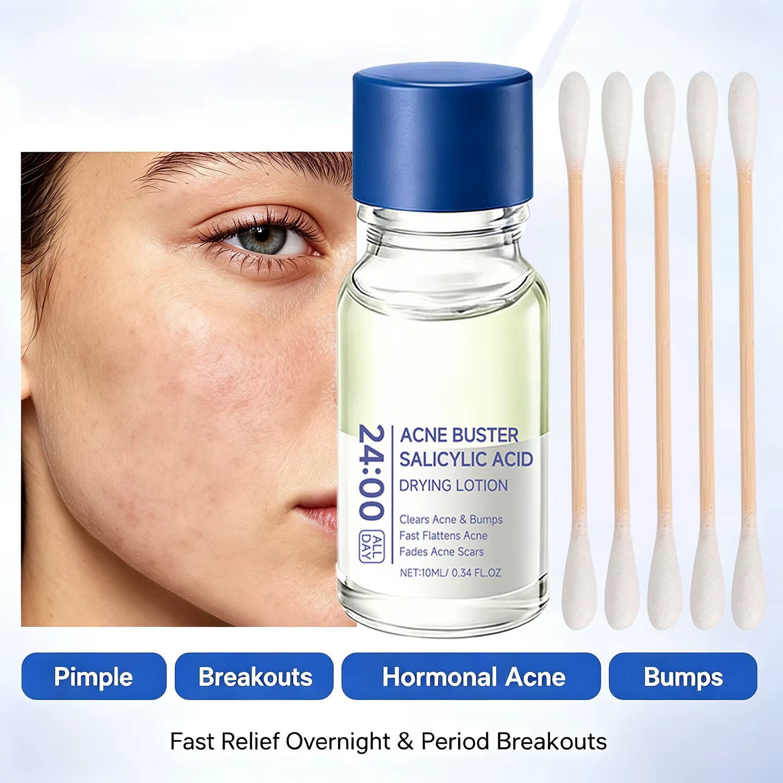 Sérum Traitant l'Acné à l'Acide Salicylique et Niacinamide – Correcteur de Taches, Soulagement des Boutons, Estompe les Marques d'Acné, Contrôle du Sébum pour Peaux Sensibles