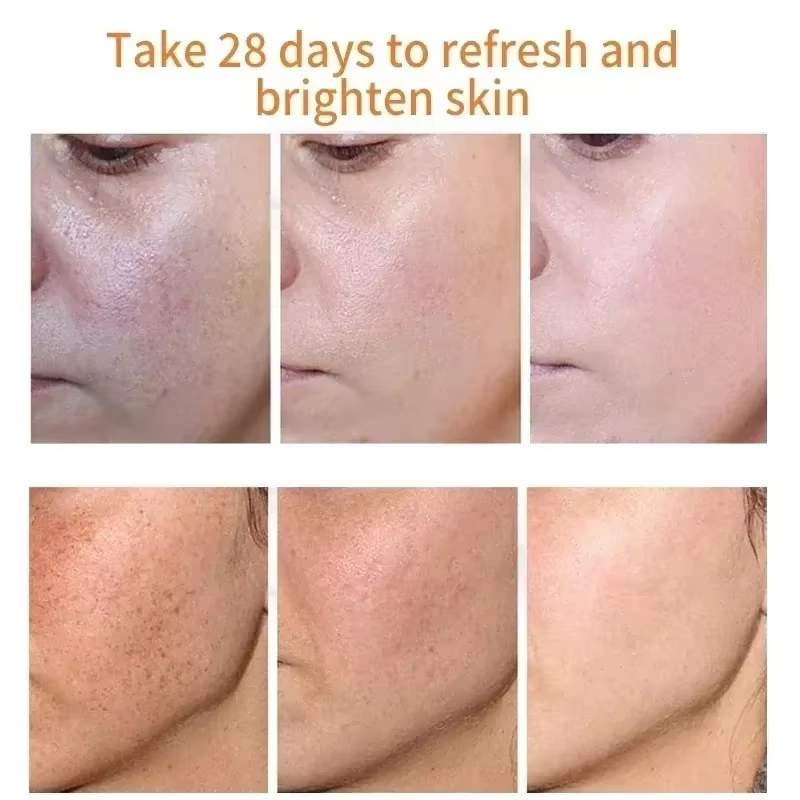 Crème blanchissante à la niacinamide pour le visage