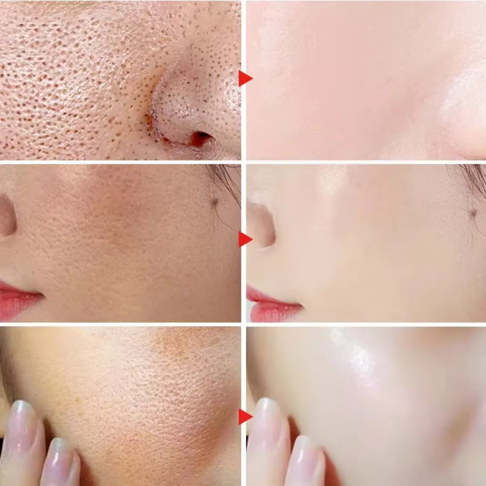 Sérum d'élimination des grands Pores