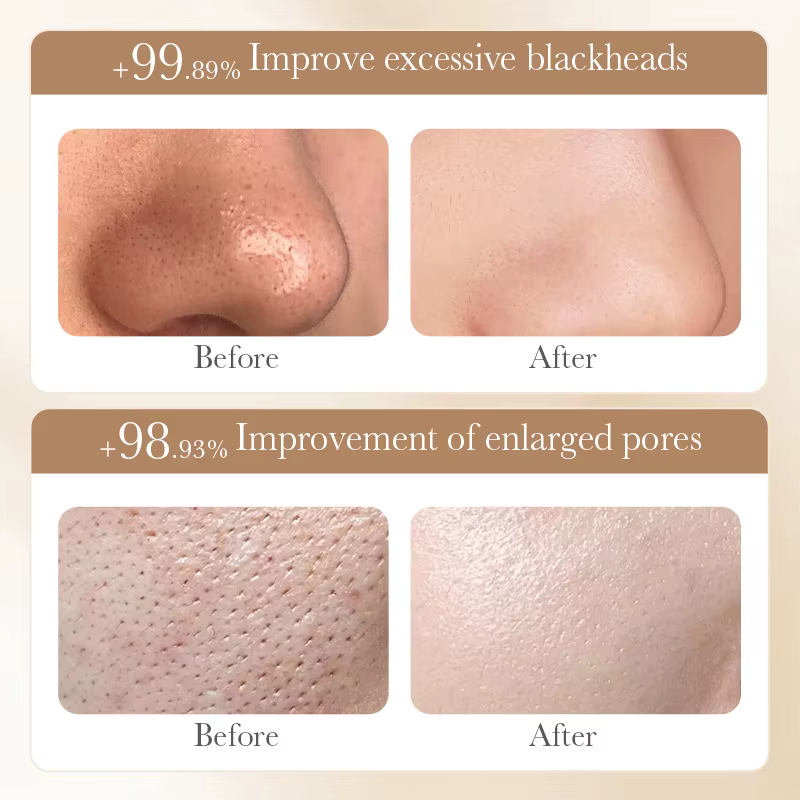 Masque exfoliant au riz blanc BIOAQUA