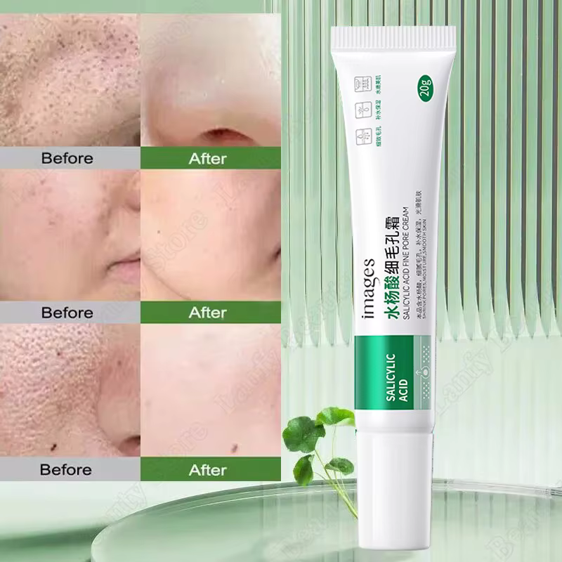 Crème de nettoyage des pores à l'acide salicVAC