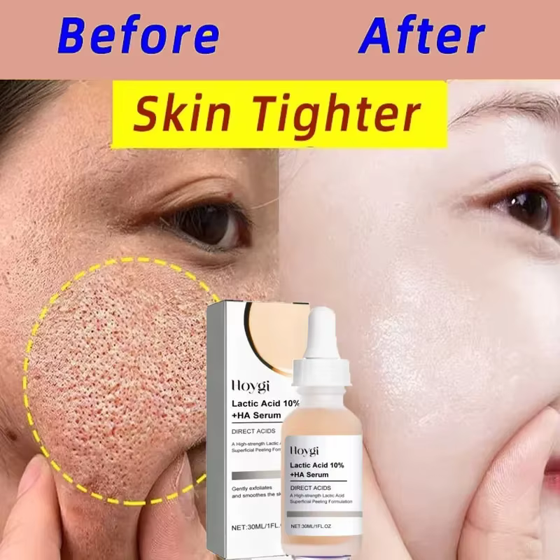 Acide lactique rétrécit les Pores sérum rapide grands