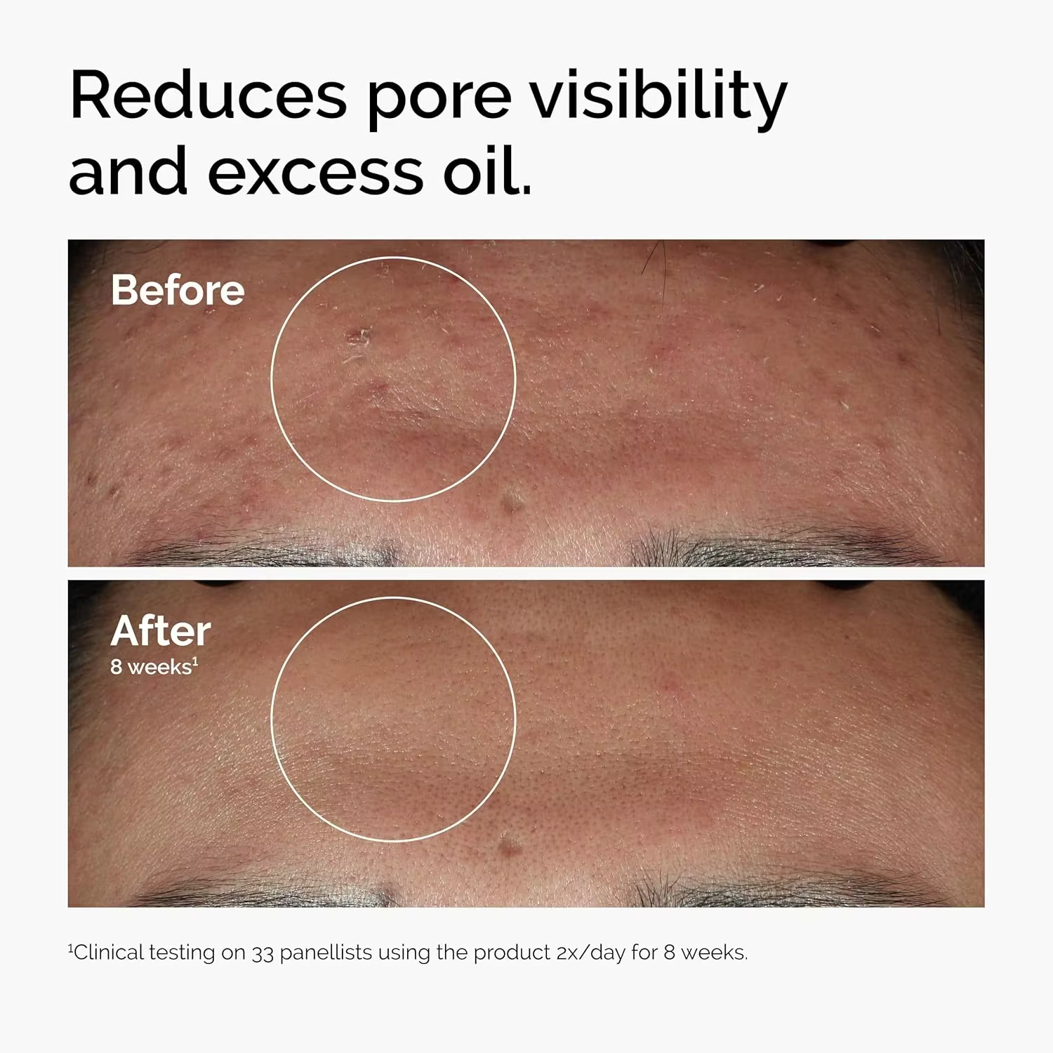 Sérum facial 10% Niacinamide 1% Zinc 30ml