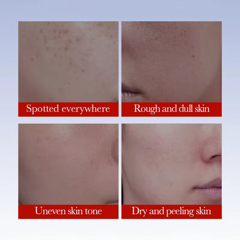 1/3/5 pièces SADOER Anti taches de rousseur crème visage crèmes blanchissantes élimination