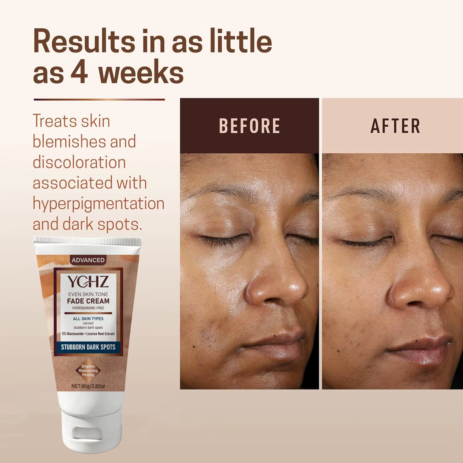 Crème anti-décoloration avancée