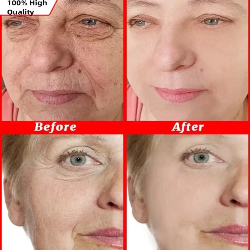 Crème anti-rides instantanée pour le visage