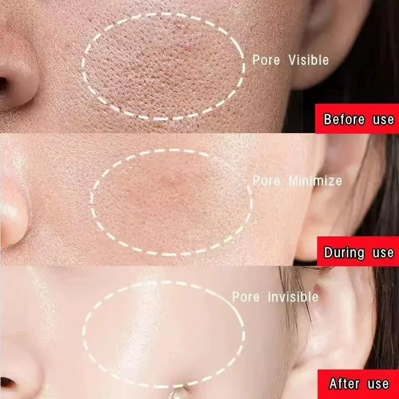 Masque Facial Original pour éliminer les points noirs