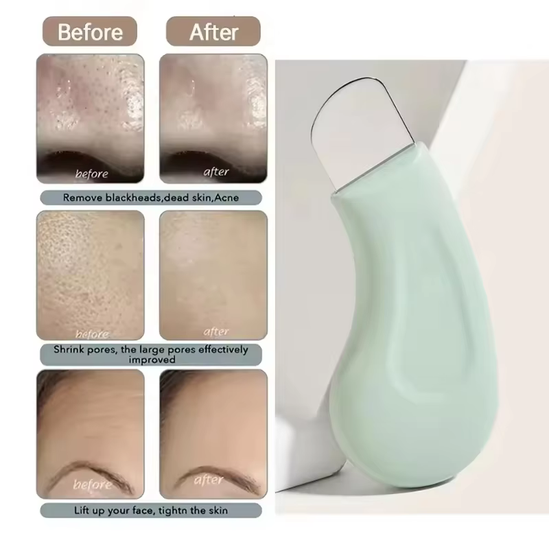 Outil d'élimination des points noirs et blancs pour le nez et le visage