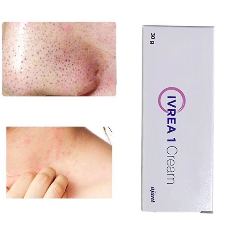Crème indienne IVREA-1 30g, apaise les bosses cutanées, le nez rouge irrité, soin quotidien doux pour la peau