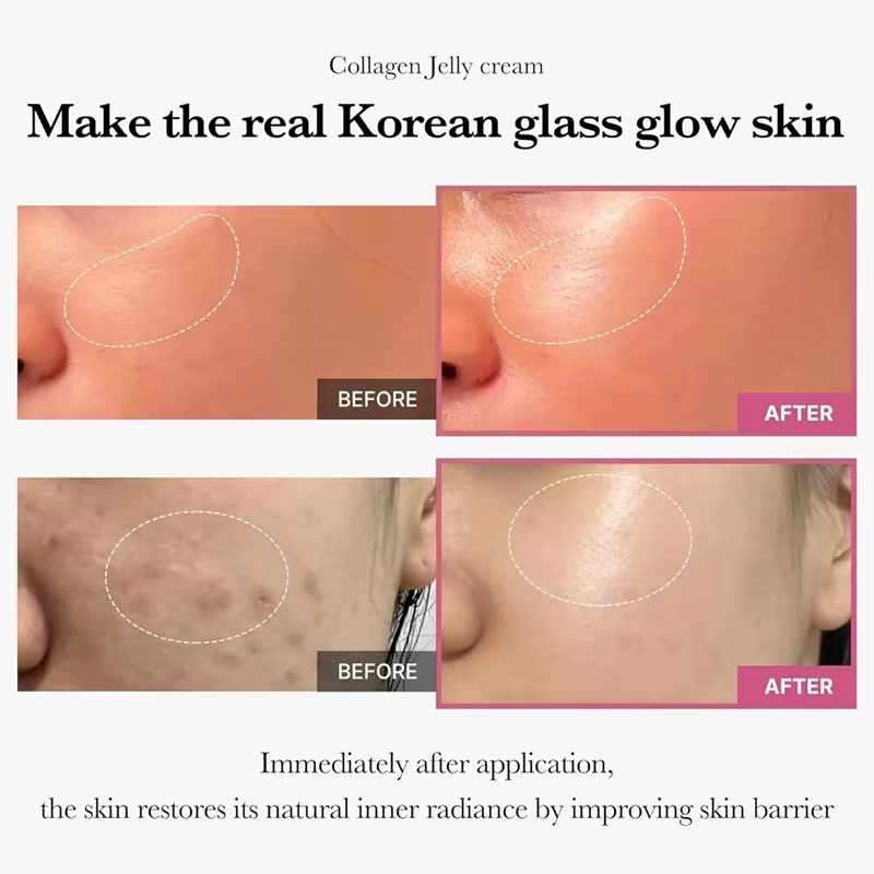 Crème Visage Gelée au Collagène 100g – Soin SPA Nourrissant Hydratant – Resserre les Pores