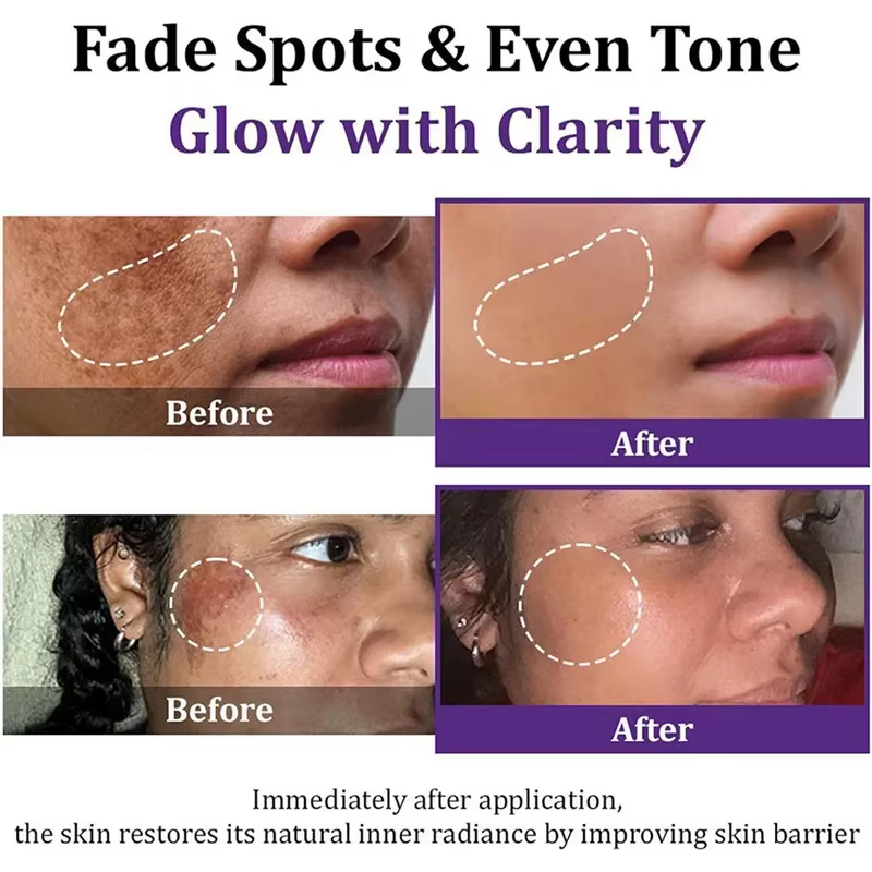 Crème éclaircissante pour le visage
