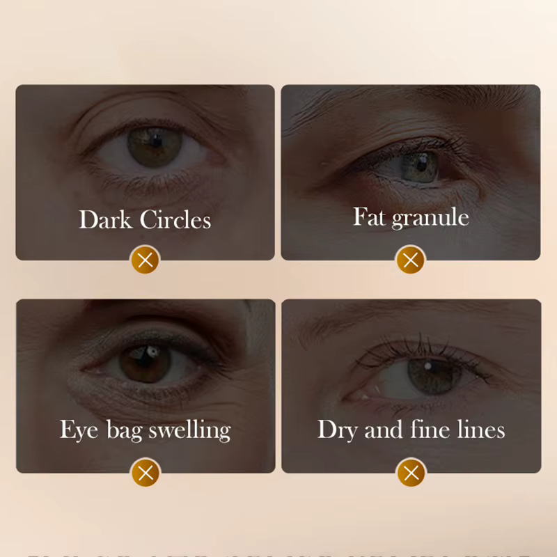 Crème pour les yeux anti-rides SADOER au peptide de venin de serpent et à la caféine