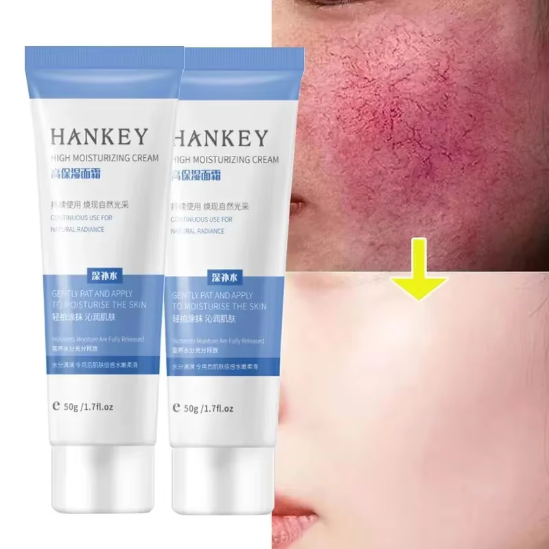 Crème réparatrice pour les rougeurs du visage