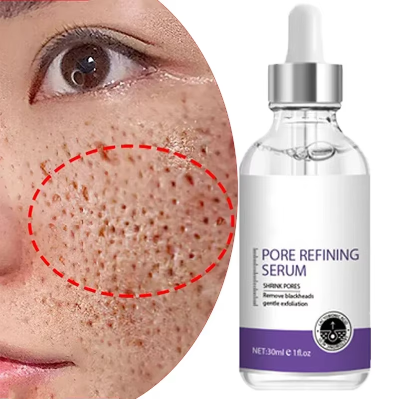 Skin Bergamo | Pore Refining Resurfacing