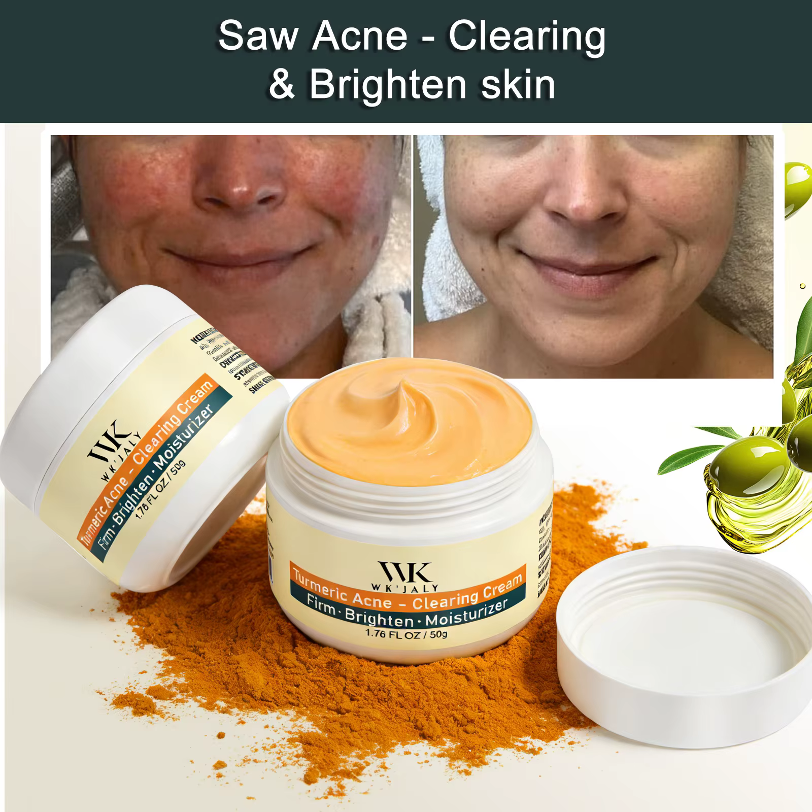Crème faciale anti-acné au curcuma WK JALY