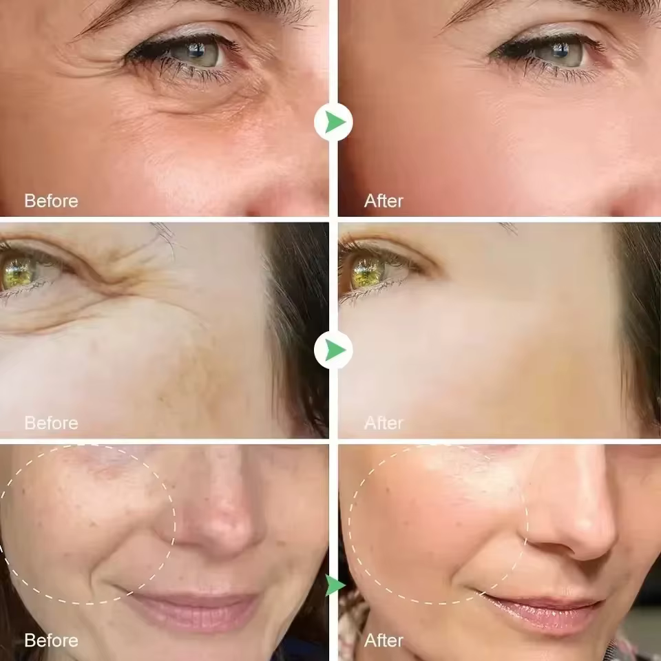 Sérum rétinol pour le visage
