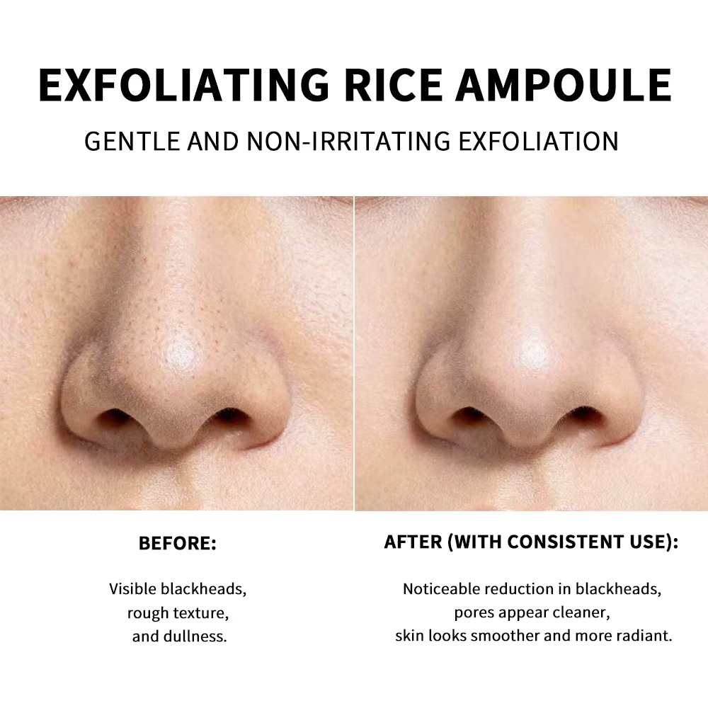 Ampoule Exfoliante au Riz : Effet Éclatant