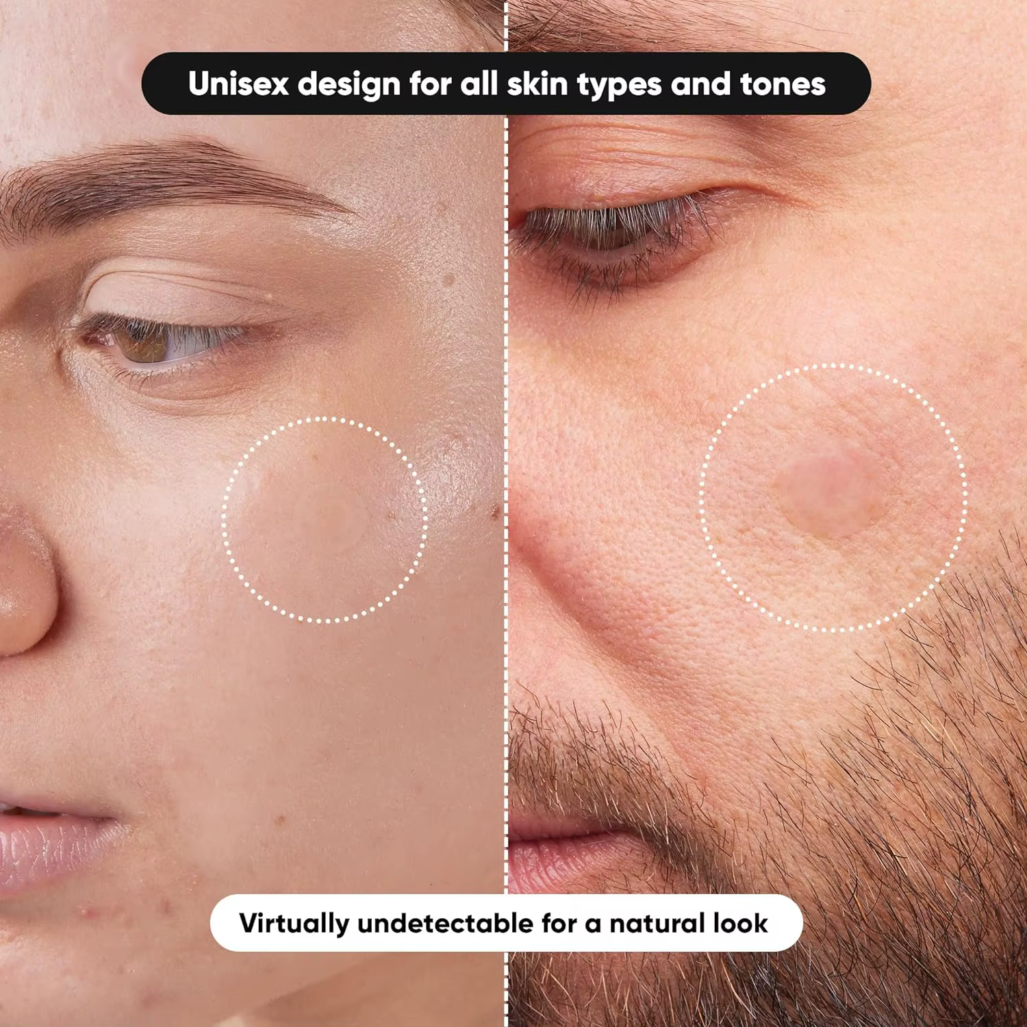 Patch hydrocolloïde Invisible imperméable pour l'acné