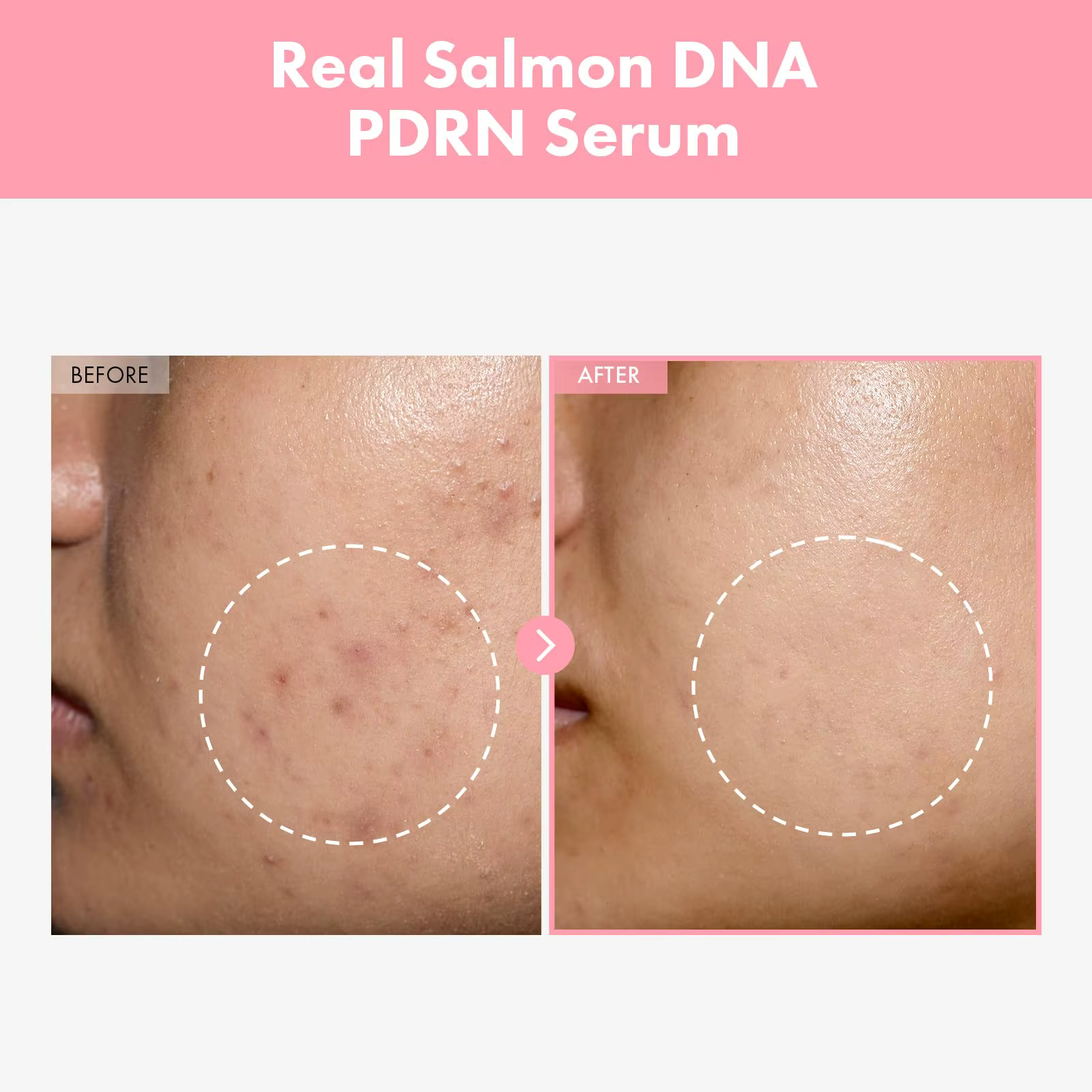 Soin du visage E-s-s-e-n-c-e Peau délicate et hydratante. Colagène hydrolysé au peptide rose pdrn