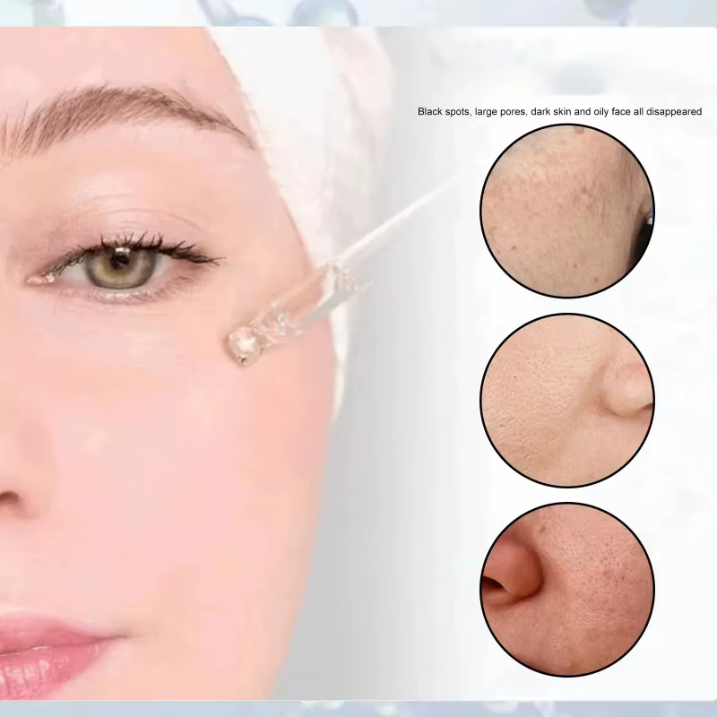 Peau lisse | Rétrécit les pores, sérum visage au rétinol et à la niacinamide