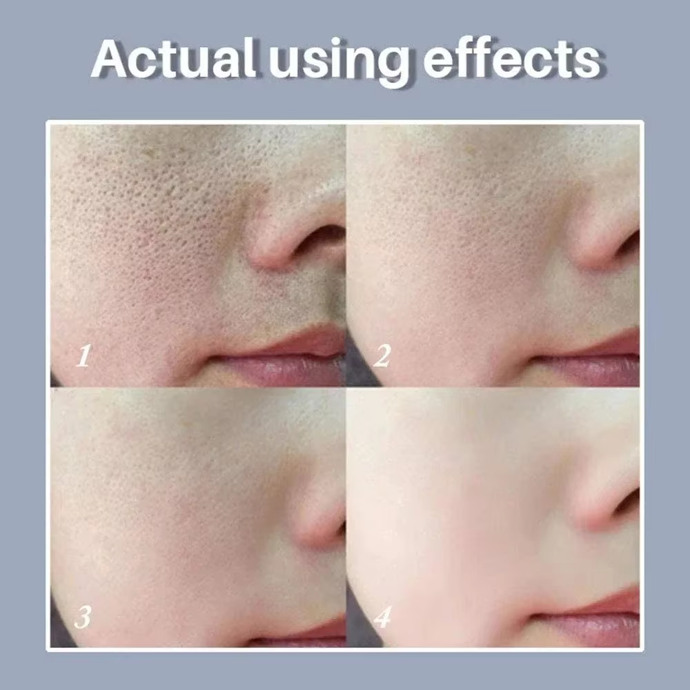 Skin Bergamo | Pore Refining Resurfacing