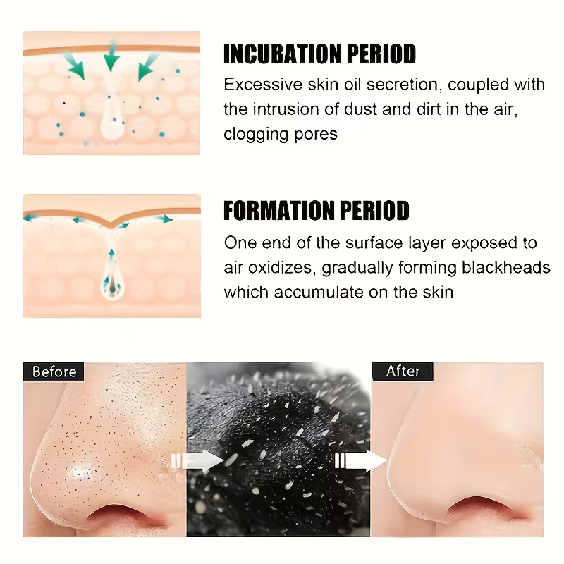 Bandes nettoyantes pour le nez sans alcool – Patchs purifiants pour les pores