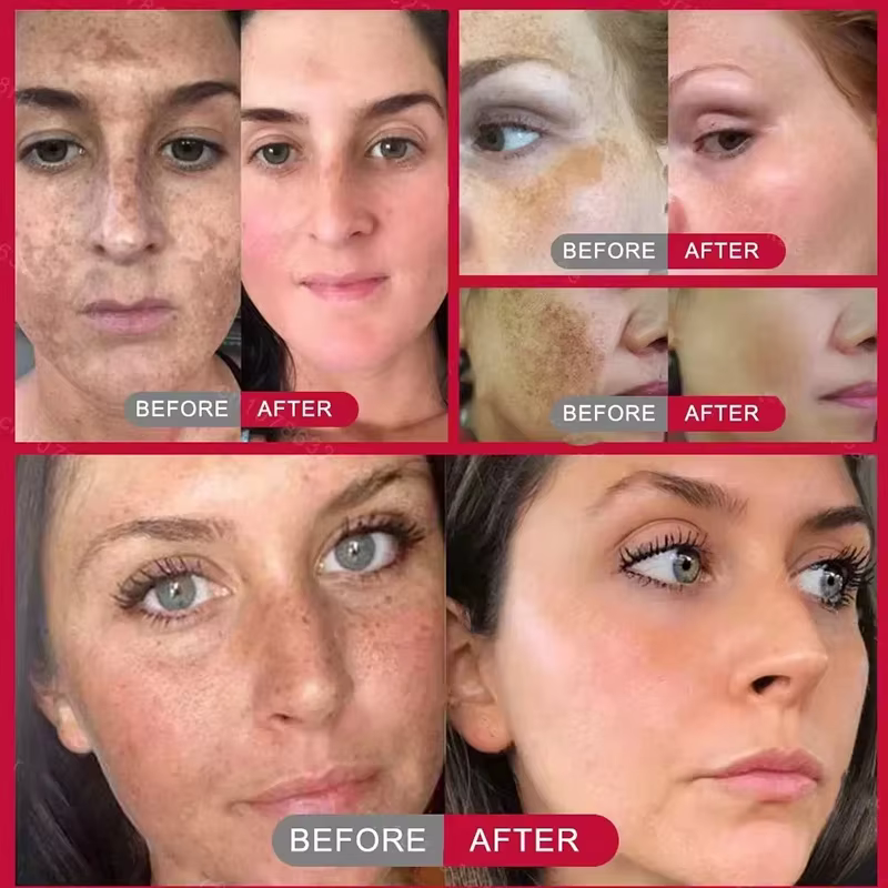 Crème blanchissante pour le visage