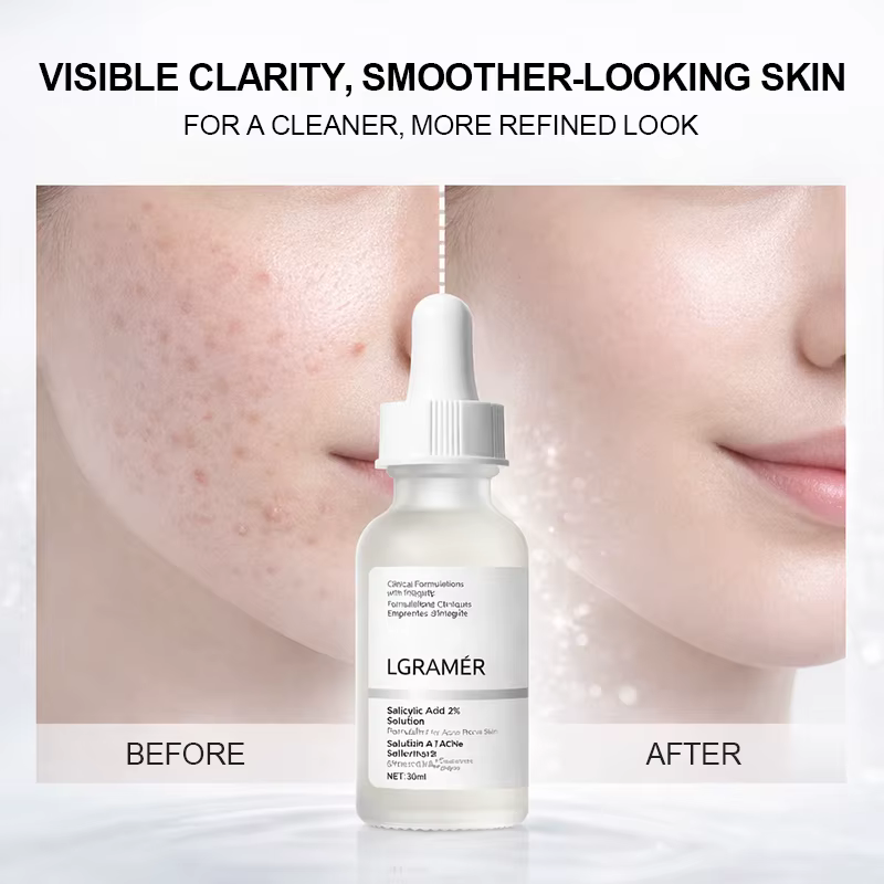 Essence faciale à l'acide salicylique à 2 %