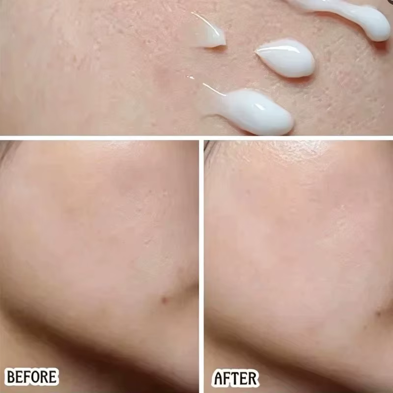 Crème et Brume Hydratante Dr.Althea 345 Relief 147 – Hydratation Intense et Éclaircissante – Produit de Soin Coréen Approuvé par les Célébrités