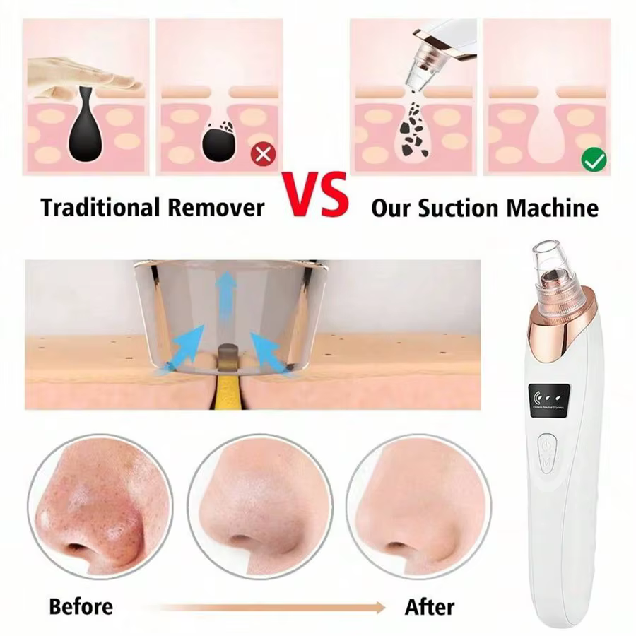 Soins électriques pour la peau du visage