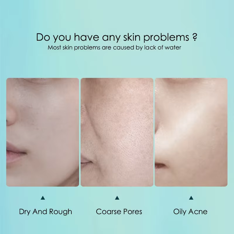 10 pièces acide hyaluronique hydratant masque Facial feuille masques pour visage