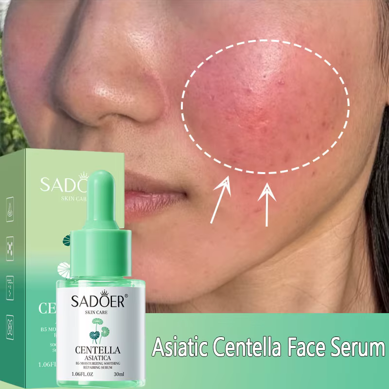 Sérum Visage à la Centella Asiatica : Réduit les Rougeurs