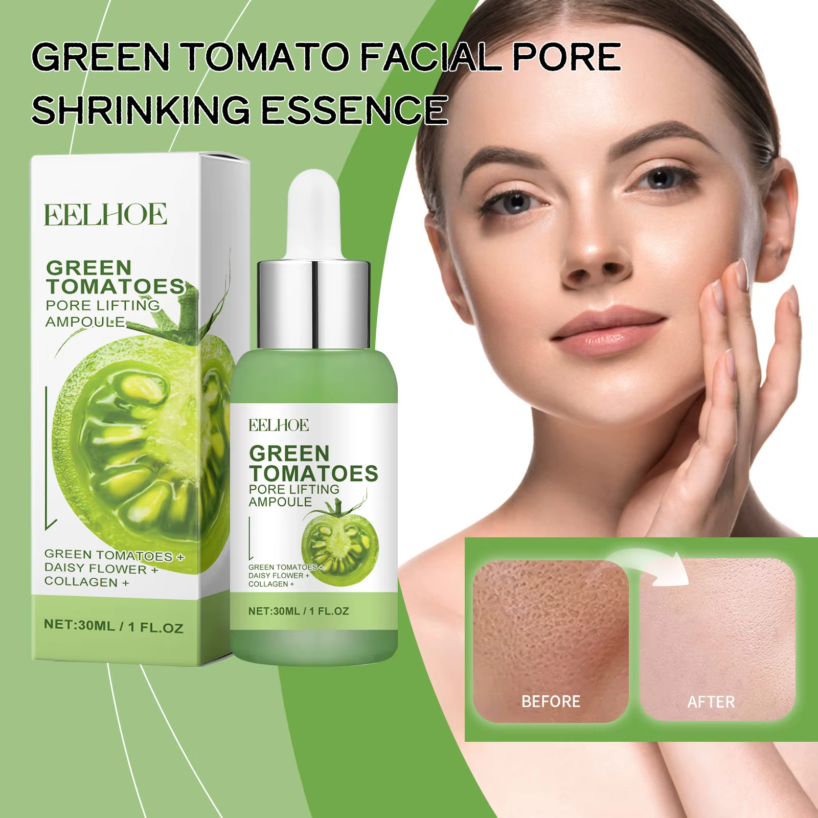 Essence de traitement des pores du visage