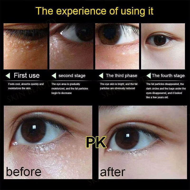 Crème pour les yeux anti-poches