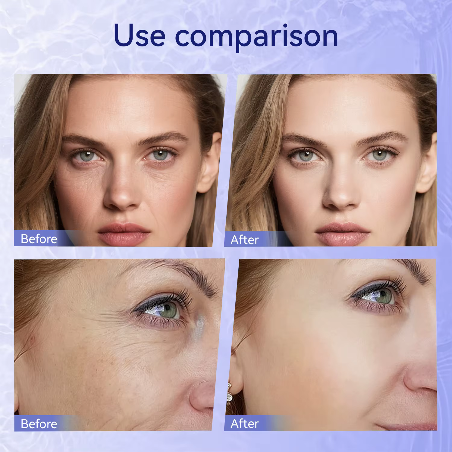 Hello Face Dermapen Électrique Microneedling - 2 Cartouches pour Infusion de Sérum à Domicile