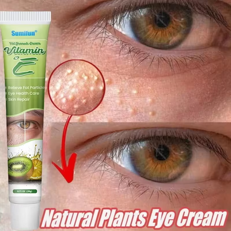 Dissolvant de granulés de graisse crème pour les yeux efficace élimine