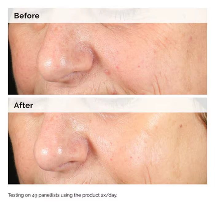 Alpha Arbutin 2% + HA 30ml Sérum Minimise L'apparence des Taches Foncés et Décoloration Hydrate La Peau