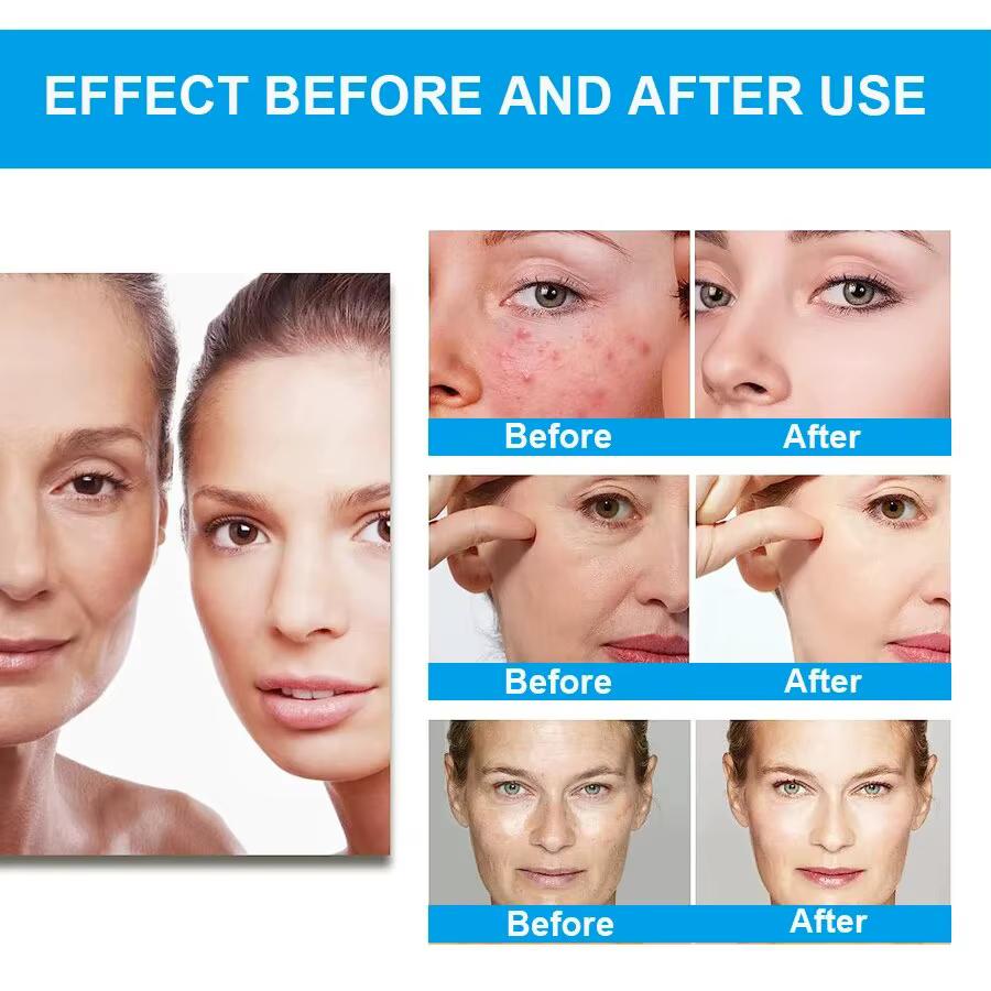 Tiroir AO Peel Water Glycolic Face Serum Expecate et Minimise les Pores